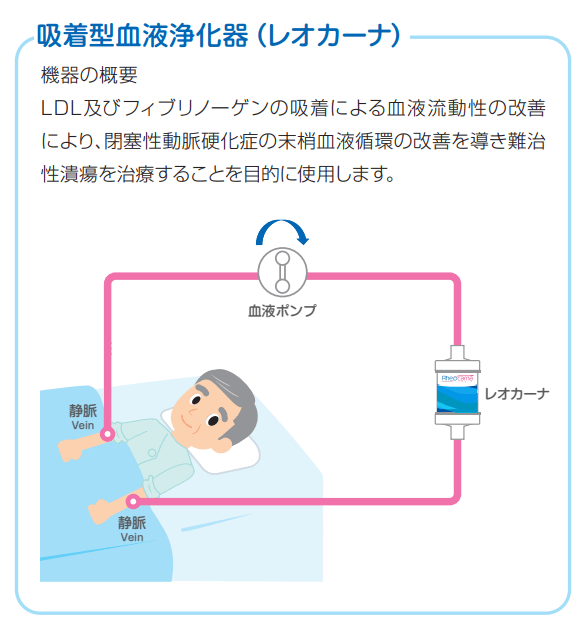 吸着型血液浄化器(レオカーナ)